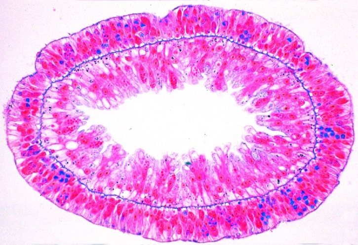 Mikropräparat - Hydra, Süßwasserpolyp quer, Entoderm, Ektoderm