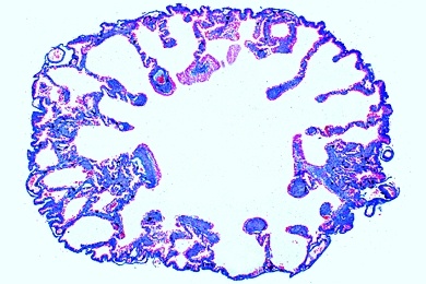 Mikropräparat - Rana, Frosch, Lunge quer. Einfache Sacklunge