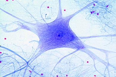 Mikropräparat - Motorische Nervenzellen aus dem Rückenmark vom Rind