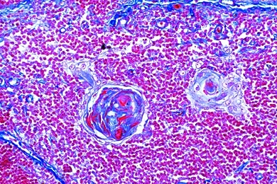 Mikropräparat - Thymus vom Rind, quer, Hassalsche Körperchen