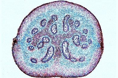 Mikropräparat - Pteridium, Adlerfarn, Rhizom quer