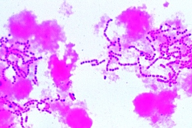 Mikropräparat - Streptococcus pyogenes, Eitererreger
