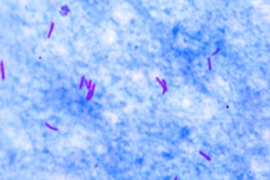 Mikropräparat - Mycobacterium tuberculosis, Tuberkuloseerreger