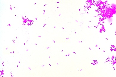 Mikropräparat - Vibrio comma, Erreger der asiatischen Cholera, Vibrionen