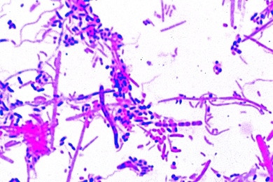 Mikropräparat - Bakterien aus dem Zahnbelag, Färbung nach Gram