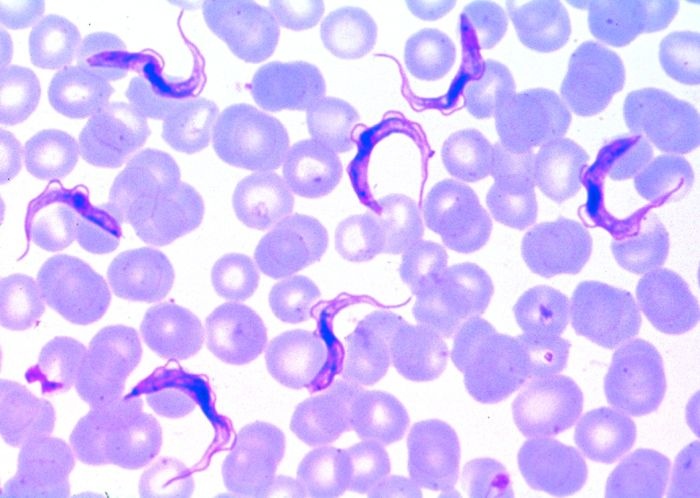 Mikropräparat - Trypanosoma gambiense, Schlafkrankheit, Blutausstrich