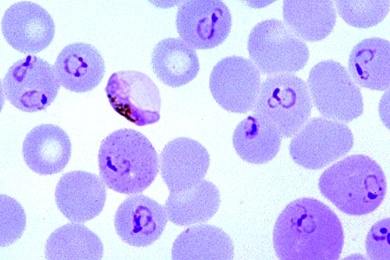 Mikropräparat - Plasmodium falciparum, Erreger der Malaria tropica des Menschen
