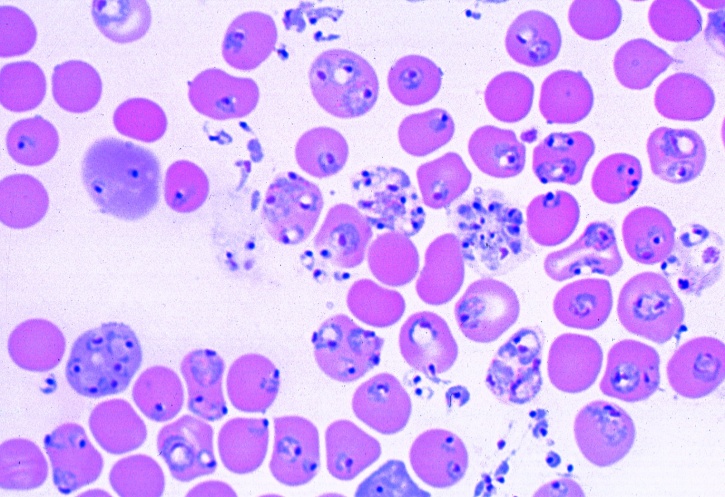 Mikropräparat - Plasmodium berghei, Malaria bei Nagetieren, Blutausstrich mit vegetativen Formen