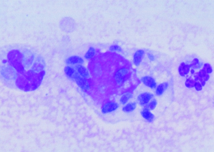 Mikropräparat - Toxoplasma gondii, Erreger der Toxoplasmose