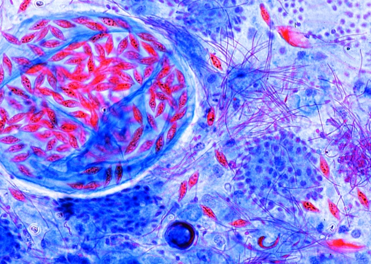 Mikropräparat - Monocystis agilis, Gregarinen aus dem Regenwurm, Ausstrich oder Schnitt mit Entwicklungsstadien