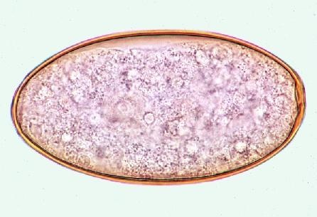 Mikropräparat - Fasciola hepatica,  Eier aus dem Gallensediment vom Rind