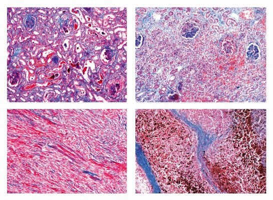 Mikropräparate - Pathologische Histologie des Menschen, Grundserie Teil II.  40 Präparate