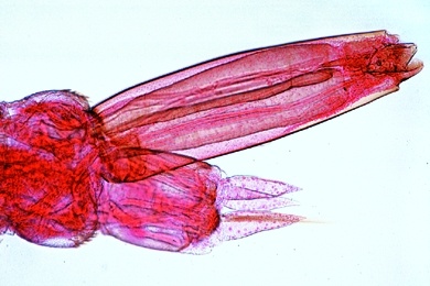 Mikropräparat - Culex pipiens, Stechmücke, Larve tot