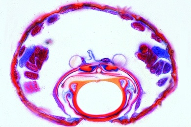 Mikropräparat - Culex pipiens, Stechmücke, Stechrüssel des Weibchens, quer