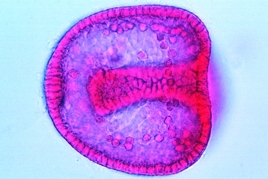 Mikropräparat - Seeigel, Blastula, fortgeschrittene Gastrulation