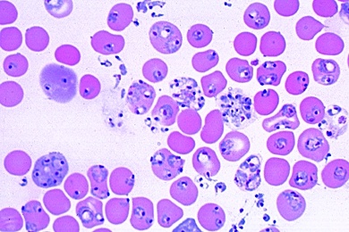 Mikropräparat - Plasmodium berghei, Malariaerreger, Blutausstrich mit Entwicklungsstadien des Parasiten (Sporentierchen)