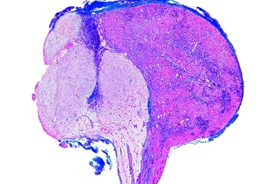 Mikropräparat - Hirnanhangsdrüse (Hypophyse) vom Menschen, quer, Adeno- und Neurohypophyse