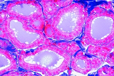 Mikropräparat - Schilddrüse (Gl, thyreoidea) vom Schaf, quer, Kolloid