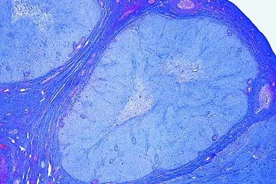 Mikropräparat - Gelbkörper (Corpus luteum) im Eierstock vom Schwein, quer