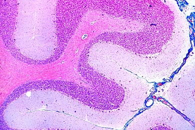 Mikropräparat - Kleinhirn des Menschen, quer, Markscheidenfärbung nach Weigert