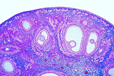 Mikropräparat - Eierstock der Katze, quer, Entwicklungsstadien der Eier: Primär-, Sekundär- und Graafsche Follikel