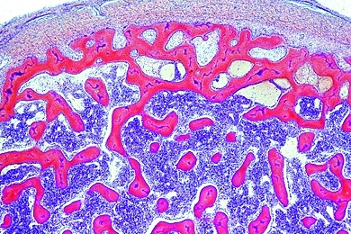 Mikropräparat - Knochen, spongiöse Substanz, quer