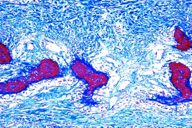 Mikropräparat - Knochenentwicklung, embryonales Schädeldach, quer