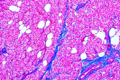 Mikropräparat - Nebenschilddrüse (Gl, parathyreoidea), quer