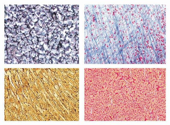 Histologie, Bindegewebe, 10 Mikropräparate, Mit ausführlichem Be