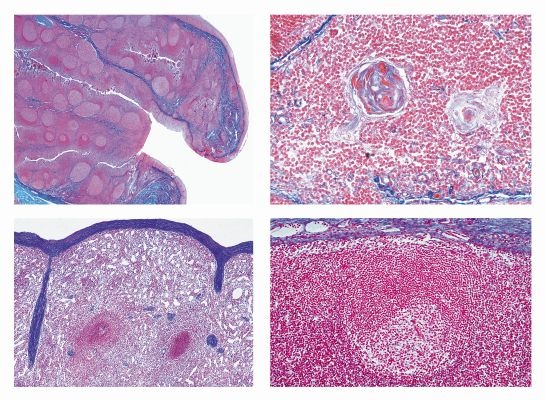 Histologie, Lymphsystem, 6 Mikropräparate, Mit ausführlichem Begleittext