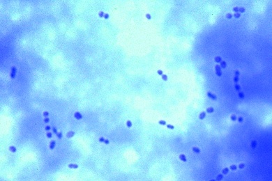 Mikropräparat - Streptococcus lactis, Milchsäurebildner, Ausstrich mit kettenförmig angeordneten Bakterien