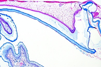 Mikropräparat - Flußkrebs, Astacus, Filtermagen, quer