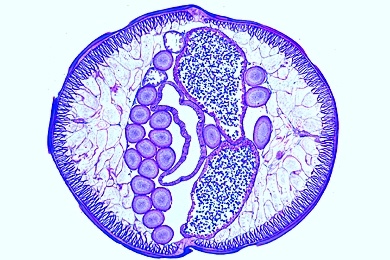 Mikropräparat - Ascaris, Spulwurm, männlich und weiblich, quer