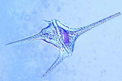 Mikropräparat - Ceratium hirundinella, Dinoflagellat aus dem Süßwasser, total