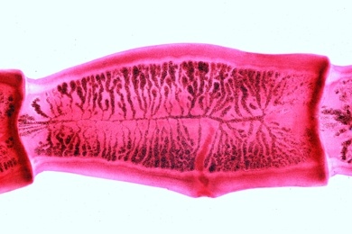 Mikropräparat - Taenia spec., Bandwurm, reife Glieder (Proglottiden), total.