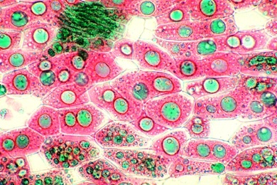 Mikropräparat - Fettes Öl im Endosperm der Haselnuß (Corylus), quer. Fettfärbung