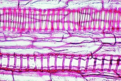 Mikropräparat - Ring-, Spiral- und Netzgefäße, isoliert