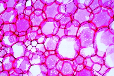 Mikropräparat - Parenchymzellen im Holundermark (Sambucus), quer