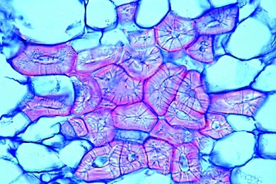 Mikropräparat - Steinzellen im Fruchtfleisch der Birne (Pyrus communis), quer