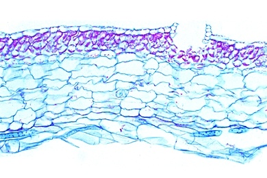 Mikropräparat - Ricciocarpos, Thallus mit Sporophyt, quer, Lebermoose (Hepaticae)