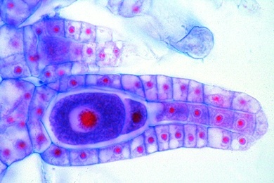 Mikropräparat - Marchantia, Lebermoos, Archegonienstand mit Archegonien, längs, Lebermoose (Hepaticae)