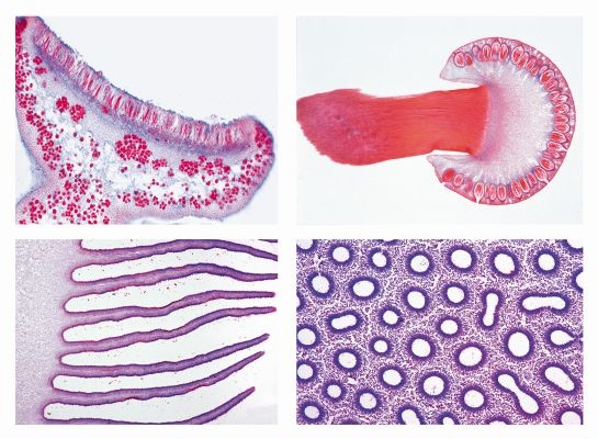 Mikropräparate in Serie - Pilze und Flechten (Fungi, Lichenes), 20 Präparate mit Begleittext