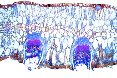 Mikropräparat - Puccinia graminis, Getreiderost, Aecidien auf infiziertem Berberitzenblatt, quer, Ständerpilze (Basidiomycetes)