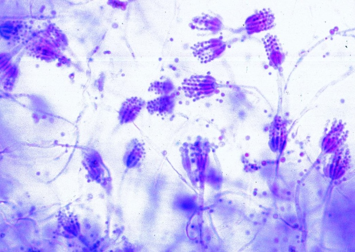 Mikropräparat - Penicillium, Pinselschimmel auf Orangenschale