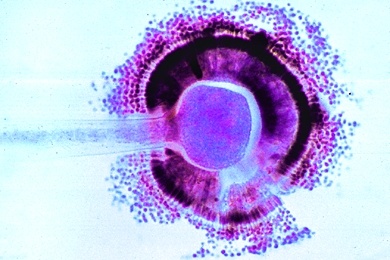 Mikropräparat - Aspergillus, Gießkannenschimmel, Konidienträger mit Konidien, Schlauchpilze (Ascomycetes)