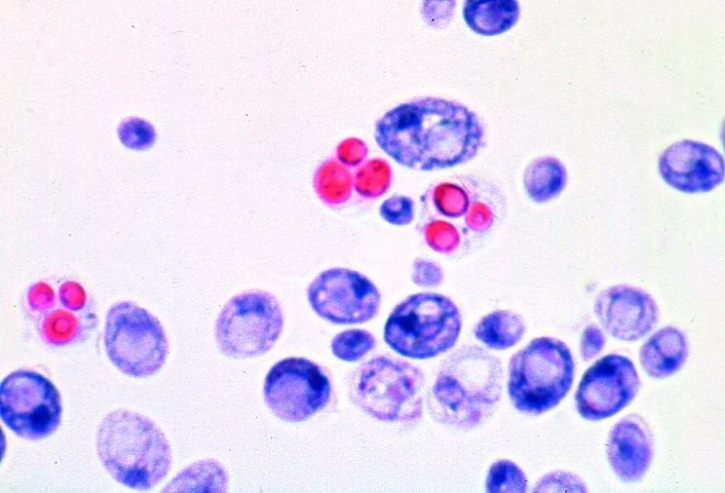 Mikropräparat - Saccharomyces, Hefe, vegetative Vermehrung, Sprossung, total, Schlauchpilze (Ascomycetes)