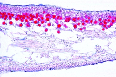 Mikropräparat - Xanthoria, Schüsselflechte, Thallus, quer, Myzel mit symbiont. Algen, Flechten (Lichenes)