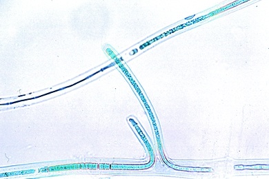 Mikropräparat - Scytonema, fadenförmige Blaualge mit Scheinverzweigungen, Blaugrüne Algen (Cyanophyceae)