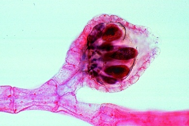 Mikropräparat - Polysiphonia, Rotalge, Thallus mit Carpogonien, total, Rotalgen (Rhodophyceae)