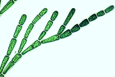 Mikropräparat - Cladophora, verzweigte Fadenalge mit vielkernigen Zellen, total, Grünalgen (Chlorophyceae)